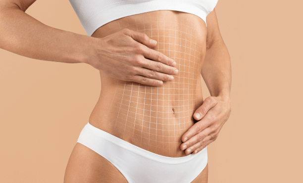 abdominoplastia