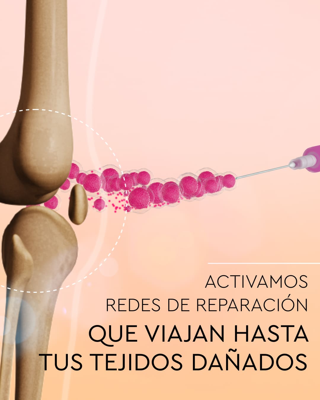 Tratamiento para el dolor de rodilla